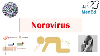 Norovirus Norwalk Virus  Transmission Pathogenesis Symptoms Prevention [upl. by Aninnaig]