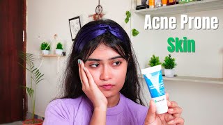 Derma Co 1 Salicylic Acid Gel Facewash Honest Review [upl. by Laeynad]