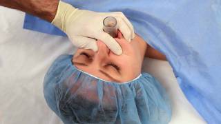 NuMask in Anesthesiology IntraOral Mask IOM®  Oropharyngeal Airway OPA Training Video [upl. by Theodor]