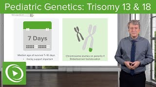 Trisomy 13 amp 18 – Pediatric Genetics  Lecturio [upl. by Turley]