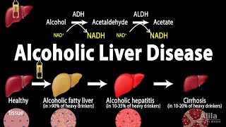 Alcoholic Liver Disease Animation [upl. by Desirea]