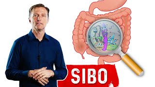 Small Intestinal Bacterial OvergrowthSIBO Steals Your Nutrients – DrBerg [upl. by Nosam295]