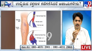 Nimma Doctor  Treatment For Varicose Veins  Megavin Vascular Care [upl. by Enautna474]