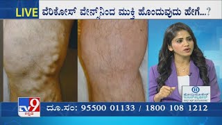 Nimma Doctor  Homeopathic Treatment For Varicose Veins  Homeocare International [upl. by Ahseym]