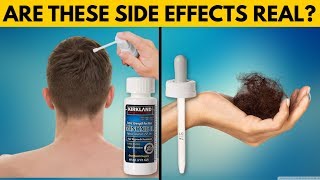 REAL TRUTH About Minoxidil Side Effects [upl. by Cristy]