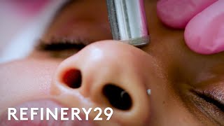 What Microdermabrasion Looks Like Up Close  Macro Beauty  Refinery29 [upl. by Azeria]