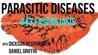 Parasitic Diseases Lectures 43 Fascioliasis [upl. by Sarazen]