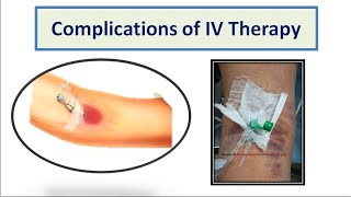 Complications of IV Therapy [upl. by Radnaskela80]