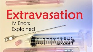 Extravasation  IV Infiltration Errors Explained Doctor Interview [upl. by Aip29]