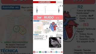 S3 Heart Sound  TERCER R3 RUIDO CARDIACO  SEMIOLOGÍA FÁCIL Auscultación Cardíaca galopenormal [upl. by Esenahs]