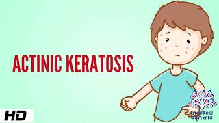 Actinic keratosis Causes Signs and Symptoms Diagnosis and Treatment [upl. by Llibyc700]