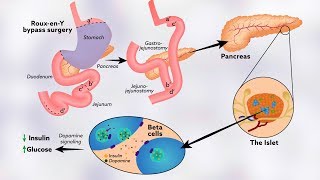 How tyrosine might help regulate glucose levels [upl. by Ladnik]