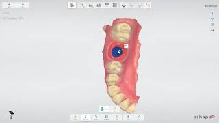 3Shape TRIOS Implant restoration workflow IT [upl. by Ellehcyt]