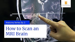 How to Scan an MRI Brain [upl. by Ocsisnarf]