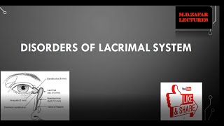 Lacrimal System Disorders [upl. by Aiyot285]