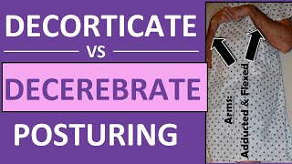 Decerebrate vs Decorticate Posturing Rigidity Mnemonic amp Pictures Nursing NCLEX [upl. by Klarrisa]