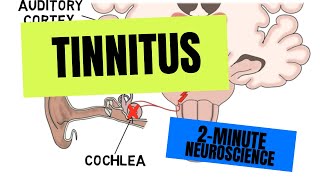 2Minute Neuroscience Tinnitus [upl. by Santiago]