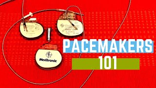 Pacemakers 101 [upl. by Scheer]