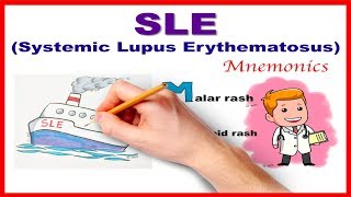 Systemic Lupus Erythematosus  Mnemonic series  25 [upl. by Tiraj]