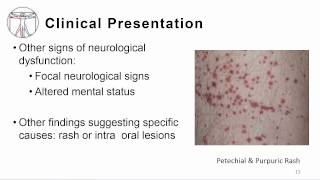 1 Overview meningitis and encephalitis [upl. by Ibbed651]