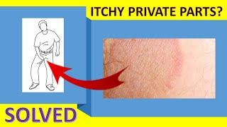 How To Cure Itching Near Private Parts  Itchy Groin Area Home Remedy [upl. by Nnoved]