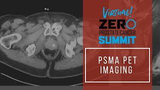 PSMA PET Imaging  Summit 2021 [upl. by Oberon]