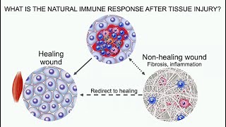 The Immune System in Regenerative Medicine [upl. by Nifled]