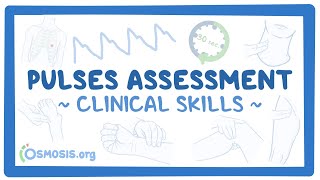 Clinical Skills Pulses assessment [upl. by Emmalynn]