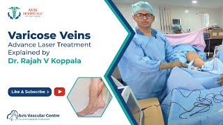 Varicose Veins Advance Laser Treatment Explained by Dr Rajah V Koppala  Avis Hospitals [upl. by Annoed940]