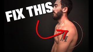 How to Fix Rounded Shoulders GONE IN 4 STEPS [upl. by Ike]