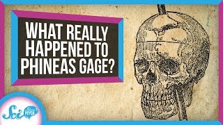 What Really Happened to Phineas Gage [upl. by Doak]