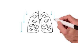 Everything you need to know about the ventilation perfusion ratio [upl. by Surat]