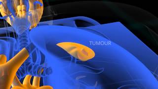 PET Scan animation [upl. by Rebmat]