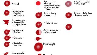 RBC Morphology [upl. by Ytinirt]