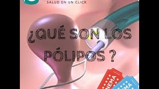 ¿Qué son los Pólipos [upl. by Demetris619]