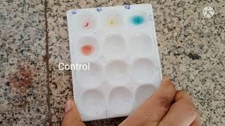 Blood group determination physiology practical [upl. by Harriett]