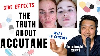 ACCUTANE  Dermatologist Review Unbiased [upl. by Elfrieda543]