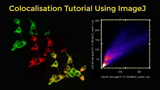 Colocalisation tutorial using ImageJ [upl. by Yntruoc]