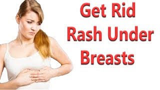 8 Remedies To Get Rid Of A Rash Under Breasts [upl. by Letram929]