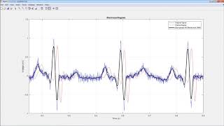 Signal Processing with MATLAB [upl. by Ayekam511]