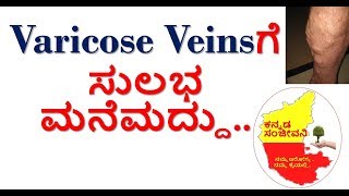 How to Cure Varicose Veins Naturally at home in Kannada  Spider Veins  Kannada Sanjeevani [upl. by Scutt]