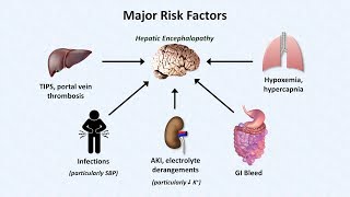 Hepatic Encephalopathy [upl. by Sherrill]