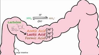 Hepatic Encephalopathy and Lactulose [upl. by Rosemaria]