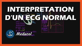 Rate and Rhythm  Premature Atrial Contraction PAC [upl. by Dalila]