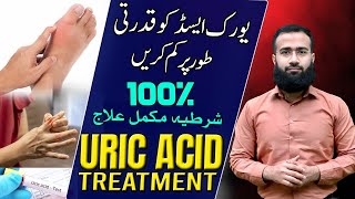 Uric Acid Treatment  Natural Remedies for GOUT Get Rid of Hyperuricemia [upl. by Labannah]