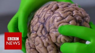 Up close with a human brain  BBC News [upl. by Fuller]