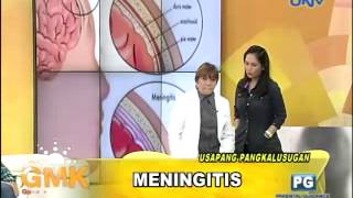 What is Meningitis [upl. by Newg]