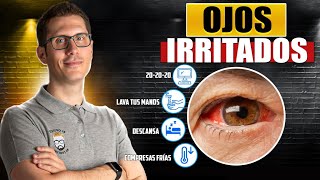 8 REMEDIOS NATURALES PARA LOS OJOS IRRITADOS [upl. by Navis]