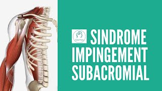 ¿Qué es Síndrome Pinzamiento SUBACROMIAL IMPINGEMENT TUTORIAL [upl. by Conal]