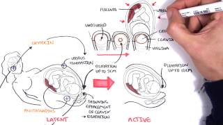 Obstetrics  Stages of Labour [upl. by Zoa]